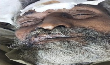 BIG NEWS: भाटखेड़ा चौराहे पर दुर्घटना में बुजुर्ग घायल, नीमच जिला अस्पताल में कराया भर्ती, उपचार के दौरान तोड़ा दम, अब POLICE को परिजनों की तलाश, अगर आपकों भी हो पहचान, तो करें इन नंबरों पर संपर्क, पढ़े खबर