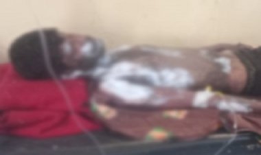 BIG BREAKING : सिंगोली के सद्दाम की उदयपुर में मौत, उपचार के दौरान तोड़ा दम, मामला खुद पर कैरोसिन छिड़क कर आग लगाने का, युवक किस कारण से था परेशान !... पढ़े आजाद नीलगर की खबर