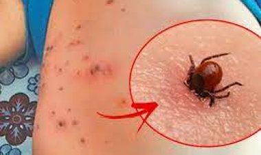 NEWS : मंदसौर में स्क्रब टाइफस की ये बीमारी,चूहों पर सवार ,ऐसे पहुंच रही लोगो में, स्वास्थ विभाग अलर्ट मोड़ पर, पढ़े ये खबर