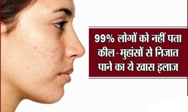 HEALTH TIPS : क्या आप भी एक्ने और मुहासे से है परेशान, तो अपनाये यह 5 नुस्के, जल्द मिलेगा इनसे छुटकारा, आइये जानते है कोनसे है वे 5 फॉर्मूले, पढ़े इस खबर में