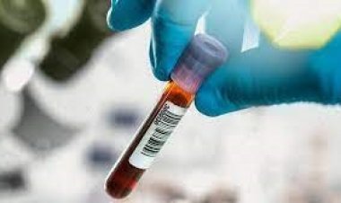 NEWS: रामपुरा नगर में नि:शुल्क कैंसर स्वास्थ्य परीक्षण शिविर का आयोजन गुरूवार को, विशेषज्ञ देंगे उचित परामर्श, पढ़े रुपेश सारू की खबर