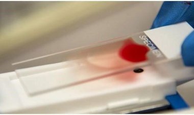 NEWS : तैयारियां पूरी, और स्थानों का भी चयन, शुक्रवार को आप भी पहुंचे यहां, बने रक्त समूह परिक्षण का हिस्सा, पढ़े खबर