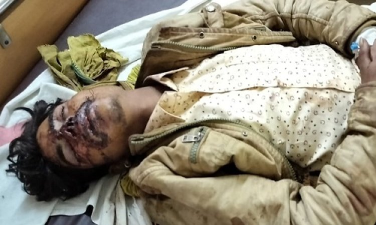 NEWS : महुड़िया गांव के पास सड़क हादसा, एक व्यक्ति गंभीर घायल, पहचान सुनील के रूप में, अगर आपको है कोई जानकारी, तो नीमच जिला अस्पताल में करें संपर्क, पढ़े खबर