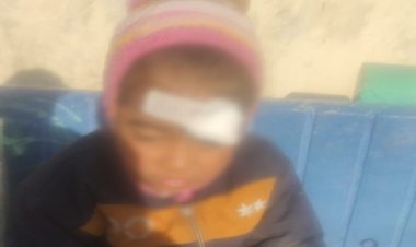 NEWS : कार और बाइक की जोरदार भिड़ंत, दंपति और बच्ची घायल, फिर मौके पर पहुंची पुलिस, पहुंचाया अस्पताल, पढ़े खबर