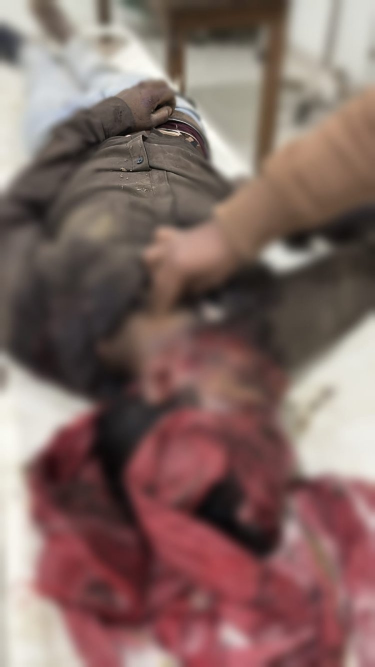 NEWS : परदा मार्ग पर बाइक हादसा, खेत की मेड से टकराया सोनू, मौके पर हुई मौत, पढ़े खबर