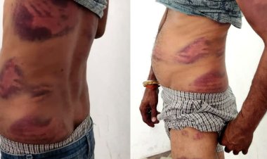 BREAKING NEWS : एथेनॉल कम आया… तो ड्राइवर पर टूटा कहर,900 लीटर के विवाद ने लिया हिंसक रूप, ऑफिस में हुई पाइप से पिटाई, पिपलियामंडी निवासी आर्यन अग्रवाल समेत तीन पर मामला दर्ज, पढ़े खबर