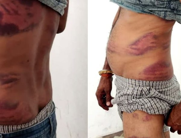 BREAKING NEWS : एथेनॉल कम आया… तो ड्राइवर पर टूटा कहर,900 लीटर के विवाद ने लिया हिंसक रूप, ऑफिस में हुई पाइप से पिटाई, पिपलियामंडी निवासी आर्यन अग्रवाल समेत तीन पर मामला दर्ज, पढ़े खबर