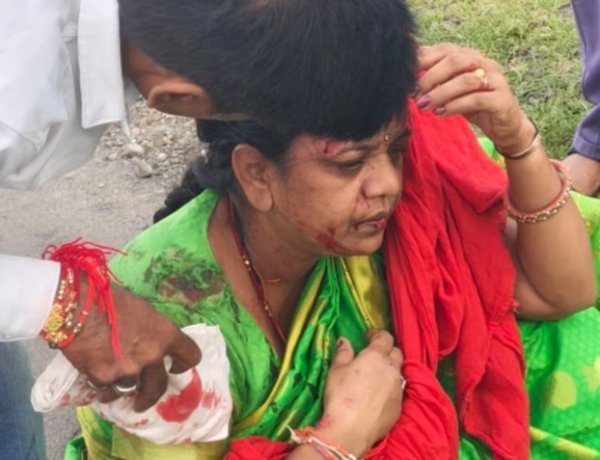 BIG NEWS: कॉलेज के सामने ‘मौत का झटका’! गतिरोधक पर बाइक का बिगड़ा संतुलन, महिला हुई घायल, रोजाना हादसों के बावजूद जिम्मेदार बेखबर, आखिर कब जागेगा विभाग?, पढ़े नरेंद्र राठौर की ये खबर